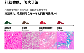 熬夜不止伤身，更伤肝：LAIFE「乐轻肝」用科学定义新一代肝脏健康方案